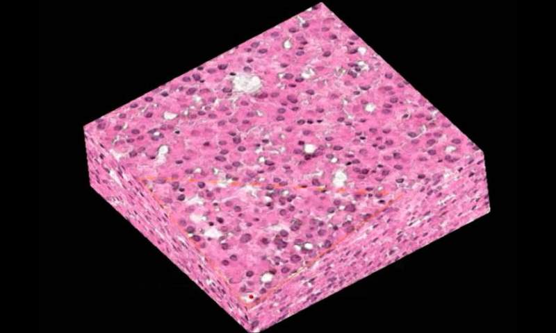 Laser microbiopsy: a minimally invasive method to extract tissue ...
