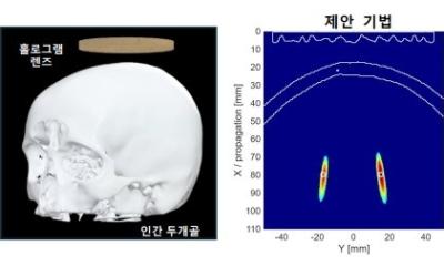 AI Hologram Technology Advances Multi-Focal Brain Stimulation