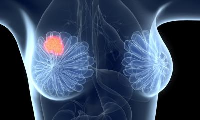 Rethinking Breast Cancer Classification: A Spectrum Approach