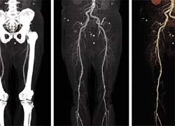 Visage CS Thin Client/Server includes tools to access CT and MR angiography...