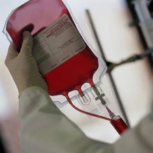Photo: Surgeons urged to think twicebefore giving blood transfusions