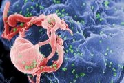 A tiny virus threatens a nation. Here: HIV-1 budding from cultured lymphocyte.