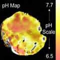 Photo: MR images reveal tumour pH