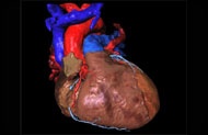 A new model provides to determine the severity of heart failure.