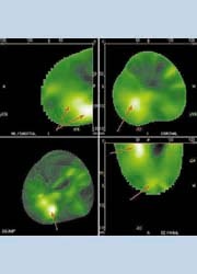 Standard 4 views, cross-sectional and 3-D. Using a cursor, tomographic sections...