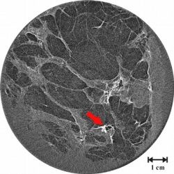 The head-to-head comparison shows it: the above picture of the breast using the...