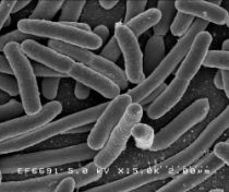 In trials Ti02 already successfully killed Escherichia coli bacteria which can...
