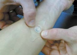 Photo: High-tech plaster for analgesic therapy