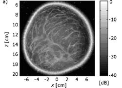 Compound image of the breast reconstructed from the distribution of the speed...