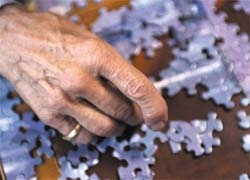 Photo: Deal to progress Alzheimers vaccine