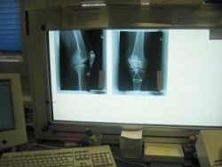 Photo: Röntgenbefundung besser durch Empathie