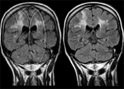 Photo: MRI software for detection & diagnosis