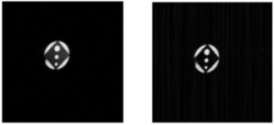 MR axial image of the phantom without (left) and during (right) 6 MV linac...