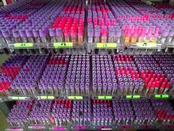 Photo: Kostengünstiger Bluttest auf Hepatitis C