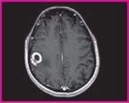 Photo: Plotting a course for contrast-enhanced MRI