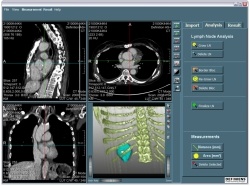 Photo: Definiens Lymphexpert launched for European Radiologists