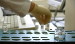 Photo: Gene Test Determines Risk of Heart Surgery Complications