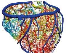 Geometric and coronary blood flow model. Source: Oxford University
