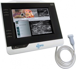 Photo: The eZono 3000 portable ultrasound system