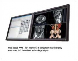 Photo: Workflow improvements with thin client PACS