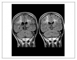 Photo: Real-time access to CT scans on laptops and PCs