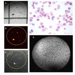 Figure 1: Labelling of cells with MRI
contrast agents.
A-C: Stem cells in a...