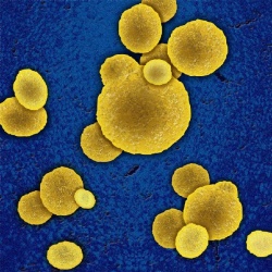 Photo: New weapons enter the un-ending war against MRSA