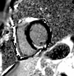 Figure 1. Cardiovascular MRI provides a 40-fold higher voxel resolution when...