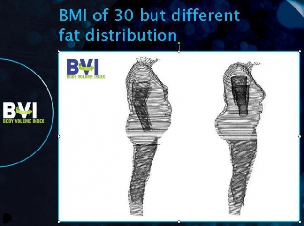 Photo: Body Volume Index (BVI) measurement launched