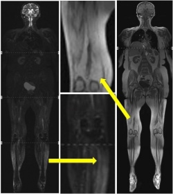 Photo: Modern radiological diagnostics for the evaluation of muscle diseases