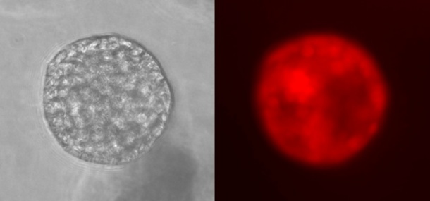 Red fluorescent cells inside an experimental tumour.