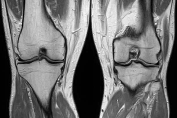 Photo: Ingenia, the first-ever digital broadband MRI system