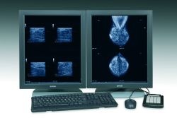 Photo: Agfa HealthCare launches new digital mammography functionality within...