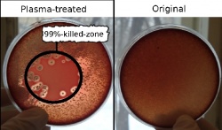 Bacterium killing with plasma: The blood-agar dishes seeded with haemolytic...