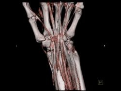 Photo: SOMATOM Definition CT Receives FDA Approval for First Six Dual Energy...