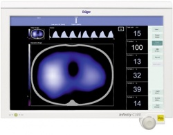 Photo: Electrical impedance tomography