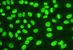 Anti nuclear antibodies - homogeneous pattern