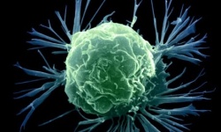 Photo: A genomic test to predict chemotherapy outcomes