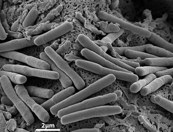 C. difficile devastates IBD patients (Copyright: Robert Koch-Institut) 