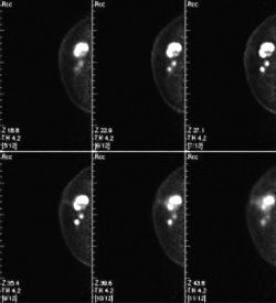 Photo: Positron emission mammography is coming to Europe