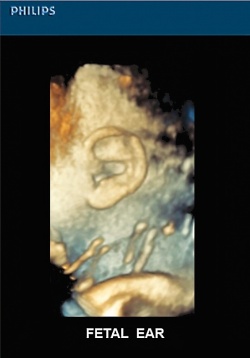Photo: From tissue uniformity to volume imaging