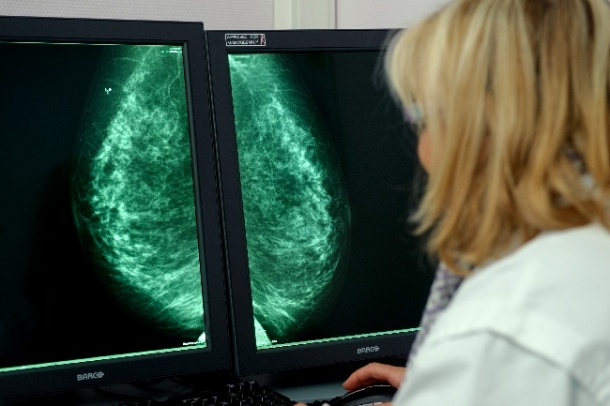 Photo: Trivialising breast cancer kills women