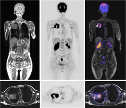 Photo: All in one: Hybrid imaging with MR/PET