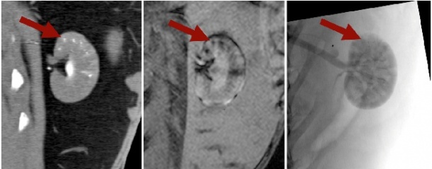 Multimodal imaging of an animal tumour model (rabbit kidney) after...