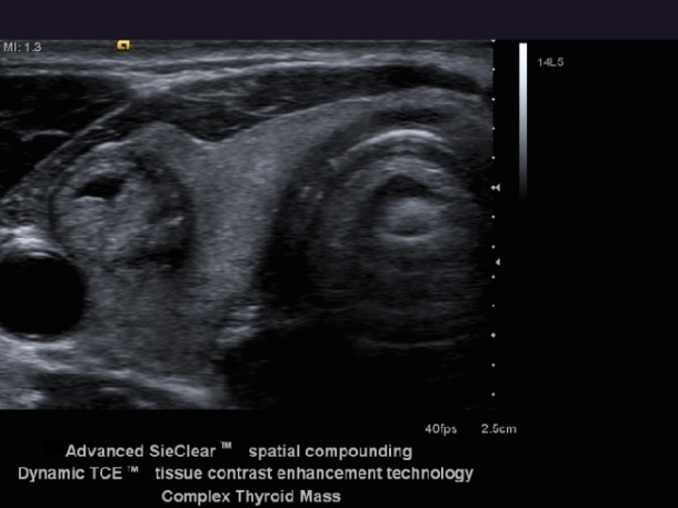 Photo: The Acuson S2000 ultrasound system