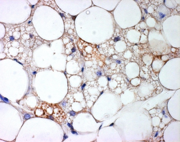 Braune Fettzellen in mitten von weißem Fettgewebe (Quelle: DKFZ)
