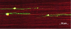 Nervenzellen der Netzhaut (grün), die an elektrisch gesponnenen Seidenfäden...