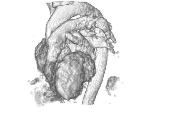 An example of a 3D image being used in the study