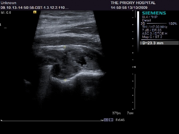 Ultrasound