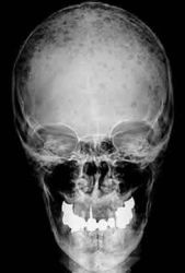 Photo: Patient dies after X-Ray blunder